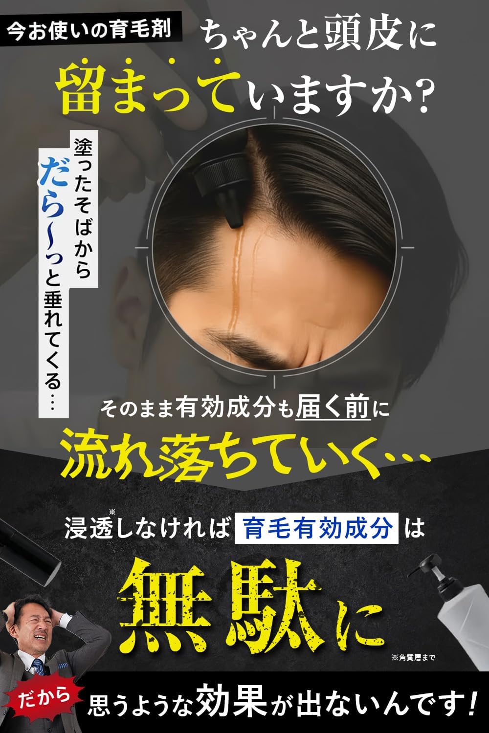 Amazon | アンサード EX7 薬用 育毛剤 3本 メンズ 男性用 [医薬部外品